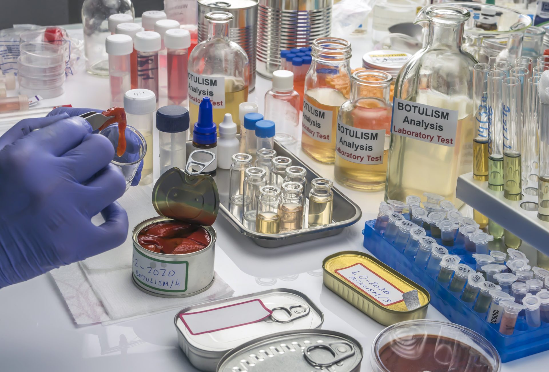 A laboratory workspace with various bottles labeled "Botulism Analysis Laboratory Test," test tubes, and lab equipment. A gloved hand is transferring contents from an opened can into a beaker for testing.